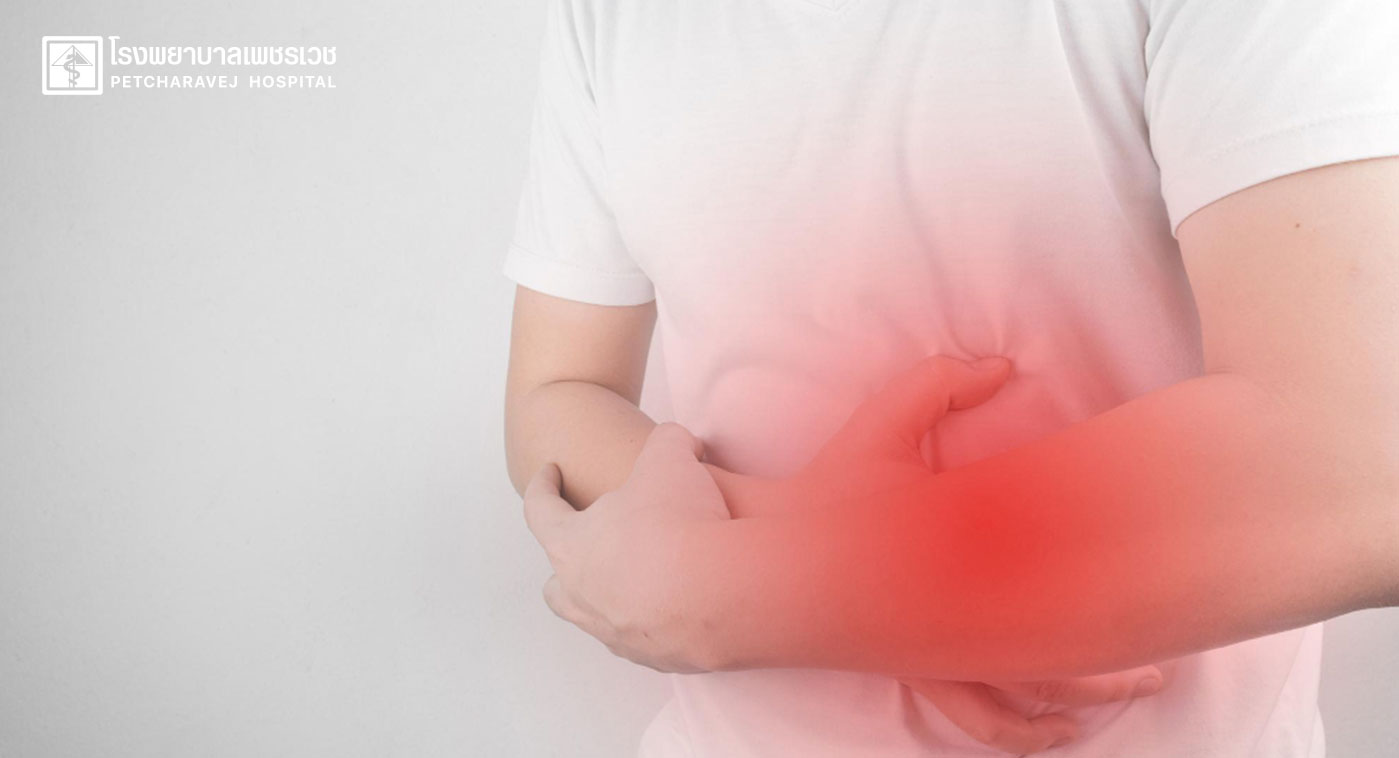 แผลในกระเพาะอาหาร แม้รักษาหายแล้วก็เสี่ยงกลับมาเป็นซ้ำได้