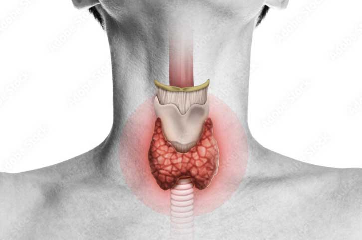 Hyperthyroidism