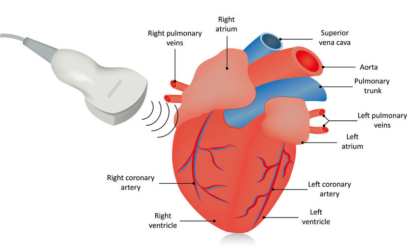 Echocardiogram